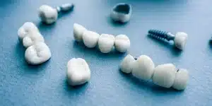 restorative-dentistry-yonge and eglinton dental