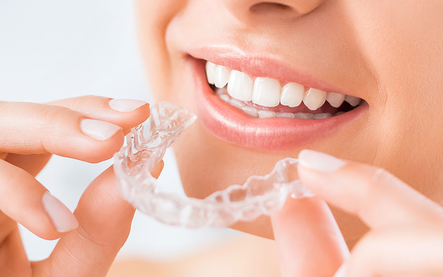 Women Holding Clear Aligners