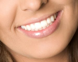 Close-up of a woman's smile with a complete, even set of white teeth