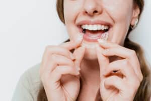 Smiling woman inserting a clear Invisalign aligner, showing discreet orthodontic care