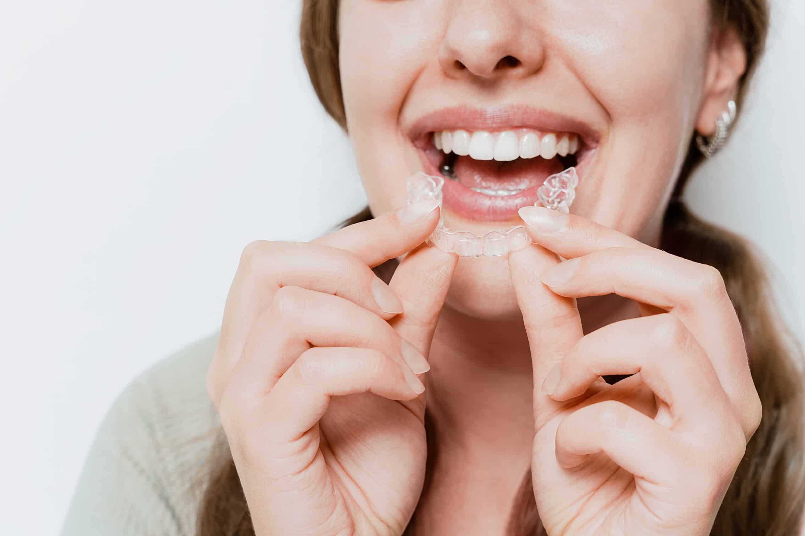 Smiling woman inserting a clear Invisalign aligner, showing discreet orthodontic care