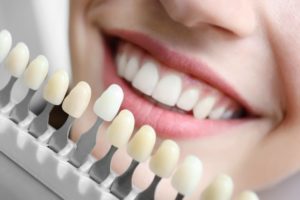 Smile Makeover Dental Procedure