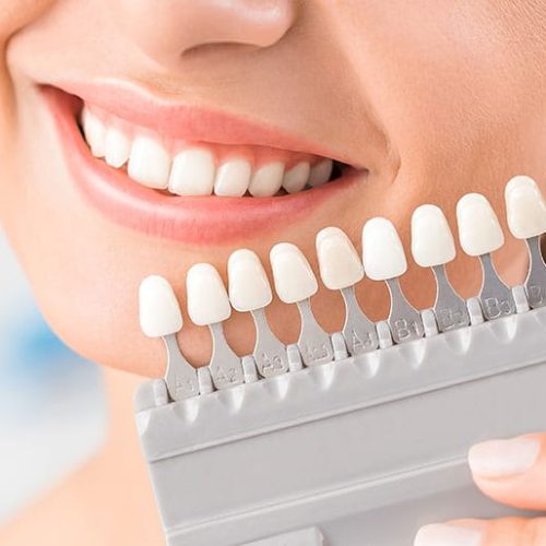 Comestic-Dentistry Comestic-Dentistry