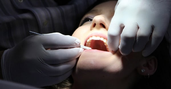 tooth-Avulsion